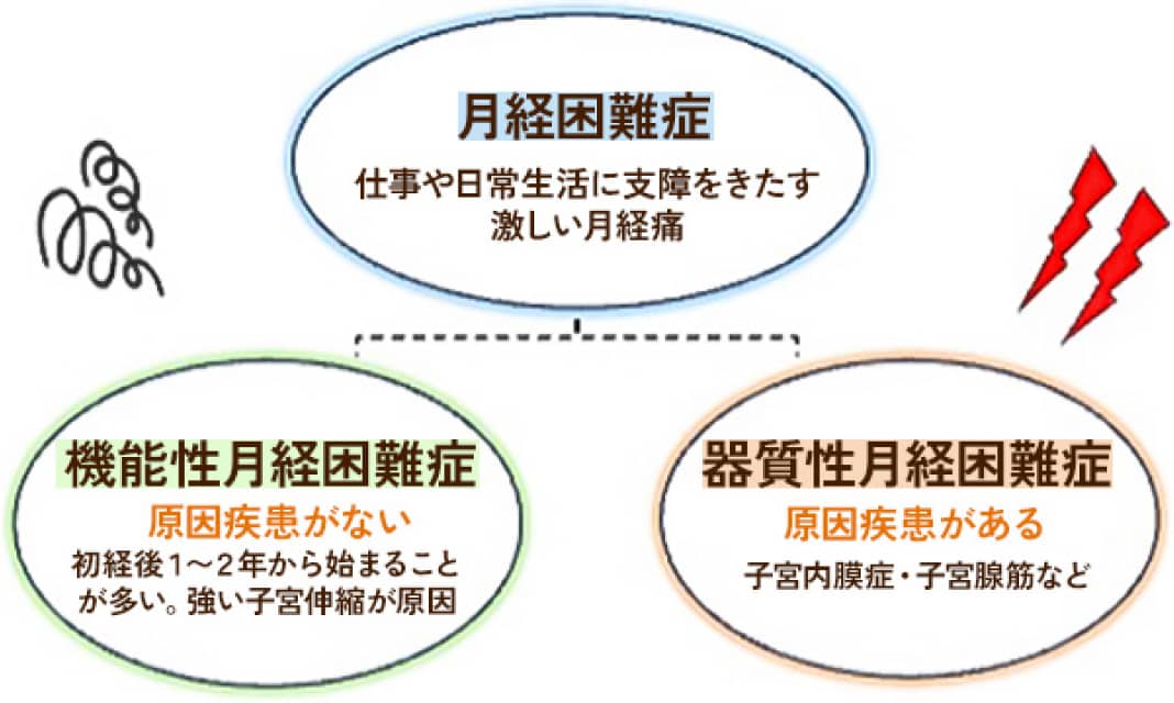 月経困難症：仕事や日常生活に支障をきたす激しい月経痛　機能性月経困難症（原因疾患がない）：初経後1〜2年から始まることが多い。強い子宮伸縮が原因　器質性月経困難症（原因疾患がある）：子宮内膜症・子宮腺筋など